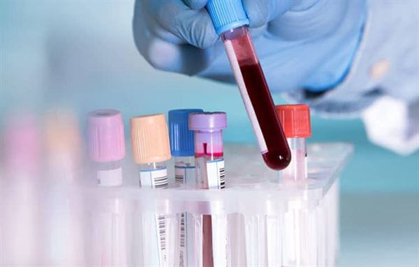 Bạn cần xét nghiệm máu thường xuyên khi sử dụng thuốc ức chế miễn dịch
